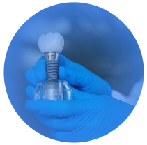 Núcleo Odontológico Fluminense - Niterói RJ // Implantes Dentários