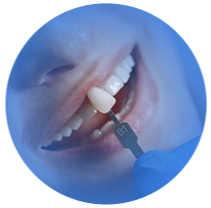 Núcleo Odontológico Fluminense - Niterói RJ // Implantes Dentários