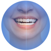 Núcleo Odontológico Fluminense - Niterói RJ // Implantes Dentários