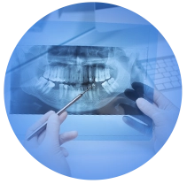 Núcleo Odontológico Fluminense - Niterói RJ // Implantes Dentários