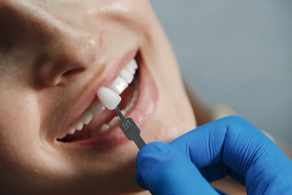 Facetas Estéticas - Niterói Rio de Janeiro // Implantes Dentários Facetas Estéticas - Niterói Rio de Janeiro // Implantes Dentários