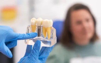 Implante dentário: quando é realmente necessário? Sinais que você não deve ignorar
