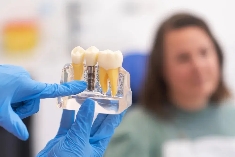 Implante dentário: quando é realmente necessário? Sinais que você não deve ignorar