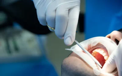 Tratamento ortodôntico: aparelho fixo ou alinhador transparente?