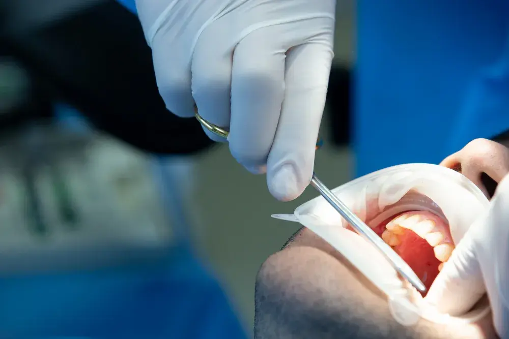 Tratamento ortodôntico: aparelho fixo ou alinhador transparente?
